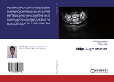 Ridge Augmentation