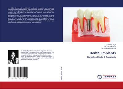 Dental Implants