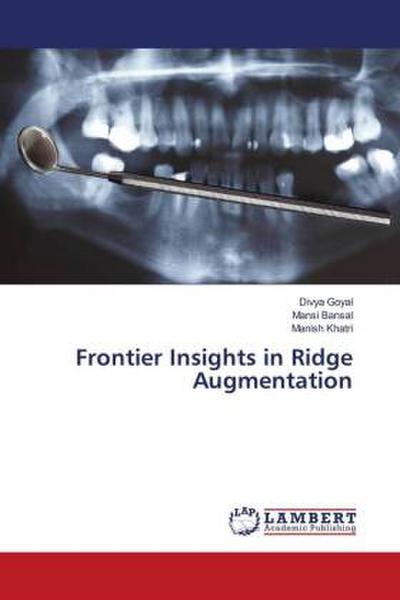 Frontier Insights in Ridge Augmentation