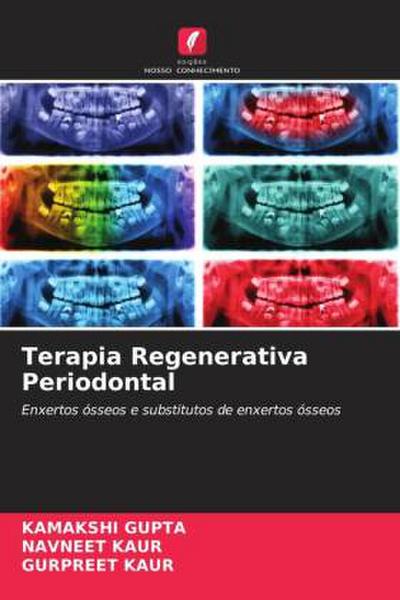 Terapia Regenerativa Periodontal