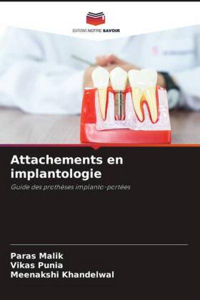 Attachements en implantologie