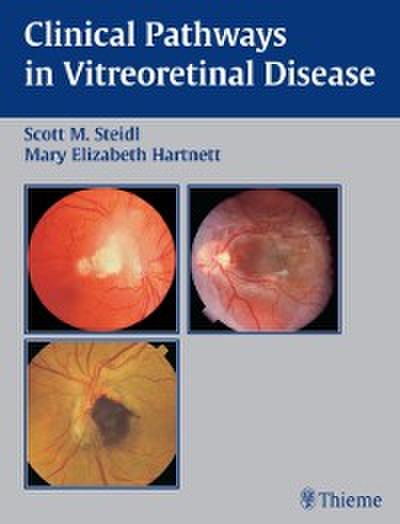 Clinical Pathways In Vitreoretinal Disease