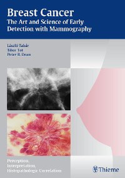 Breast Cancer - The Art and Science of Early Detection with Mammography