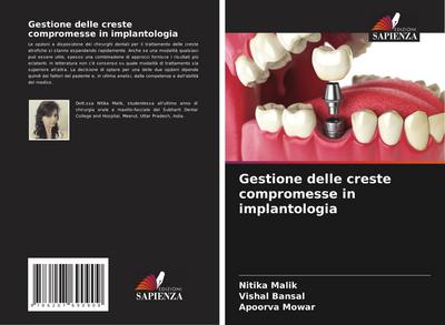Gestione delle creste compromesse in implantologia