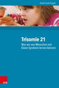 Trisomie 21 – Was wir von Menschen mit Down-Syndrom lernen können