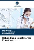 Behandlung impaktierter Eckzähne