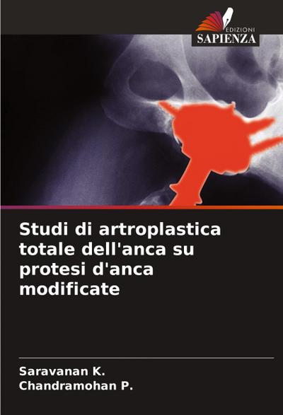 Studi di artroplastica totale dell’anca su protesi d’anca modificate