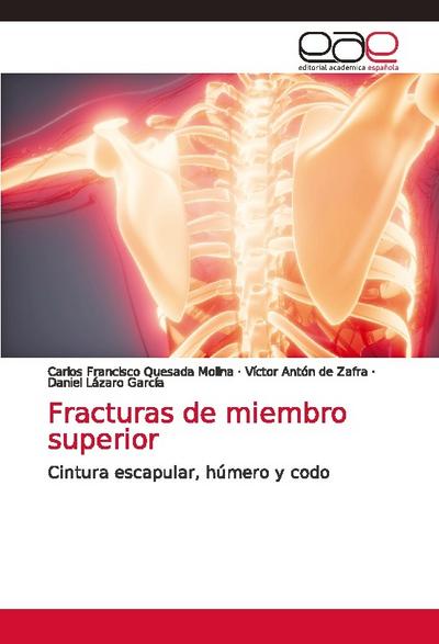 Fracturas de miembro superior