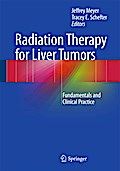 Radiation Therapy for Liver Tumors