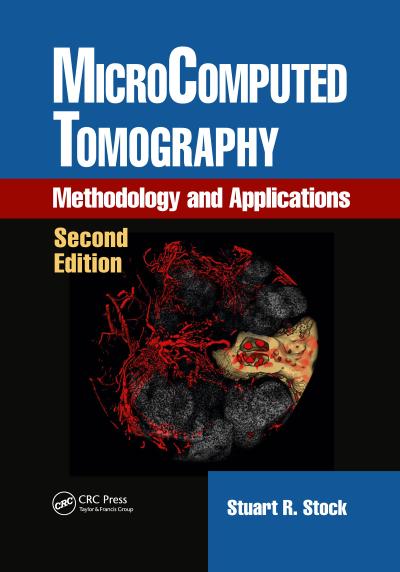 Microcomputed Tomography