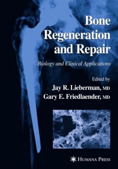 Bone Regeneration and Repair