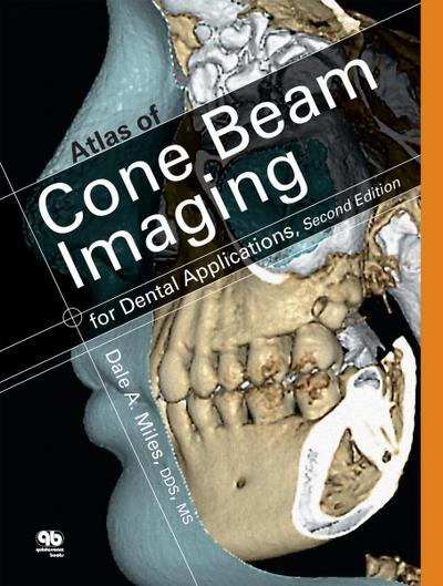 Atlas of Cone Beam Imaging for Dental Applications (eBook, EPUB) - Dale A. Miles