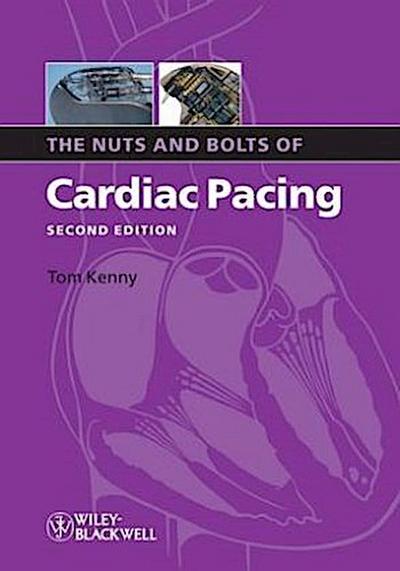 Nuts Bolts Cardiac Pacing 2e