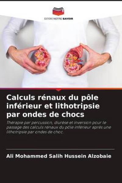 Calculs rénaux du pôle inférieur et lithotripsie par ondes de chocs