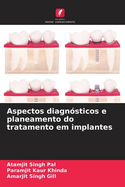 Aspectos diagnósticos e planeamento do tratamento em implantes