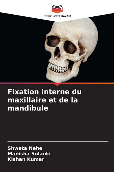 Fixation interne du maxillaire et de la mandibule