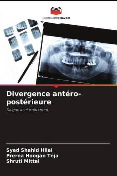 Divergence antéro-postérieure