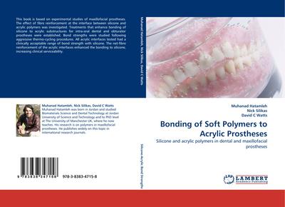 Bonding of Soft Polymers to Acrylic Prostheses