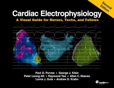 Cardiac Electrophysiology: A Visual Guide for Nurses, Techs, and Fellows, Second Edition